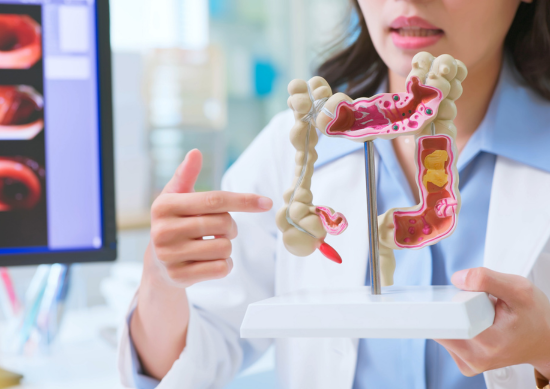 Doctor pointing to medical model of colon