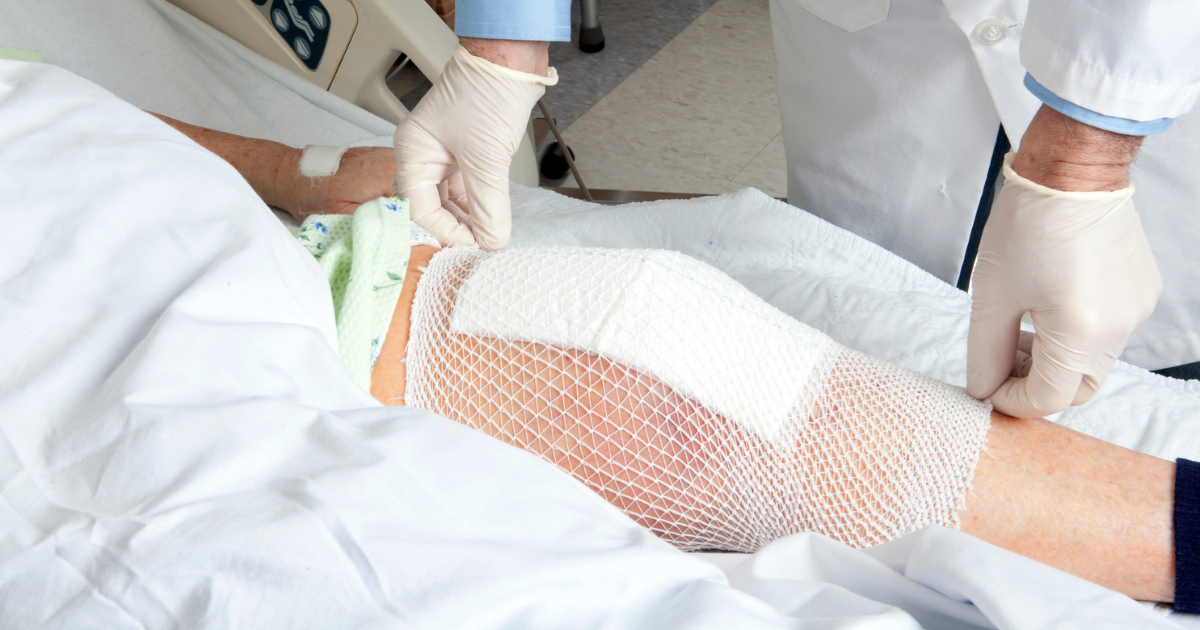 Doctor adjusting knee replacement bandage