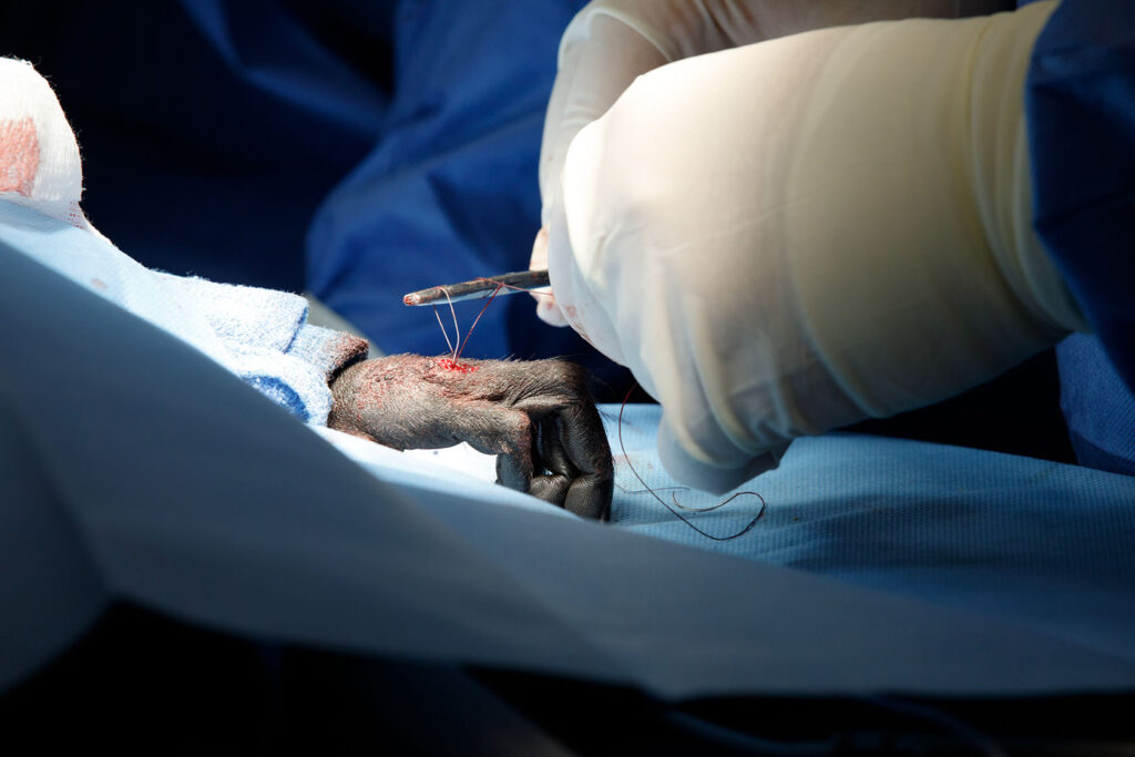 A close up of Yuki's hand during surgery.