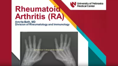 Learn more about rheumatoid arthritis