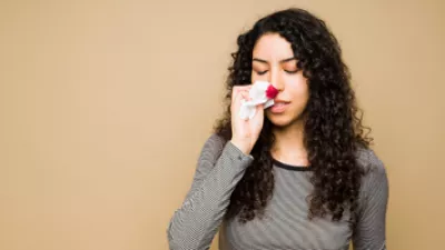 Picture of a woman with a nosebleed