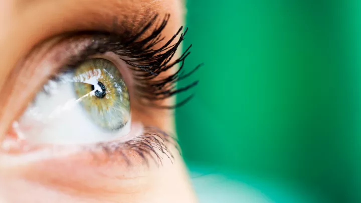 What Are Intacs® Corneal Implants For Keratoconus? 